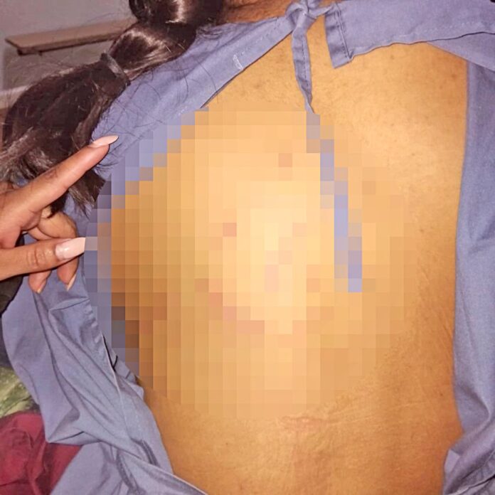 ADOLESCENTE DE 15 AÑOS ES ATACADA POR PERROS REINCIDENTES